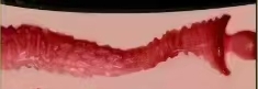 Vagina type 2